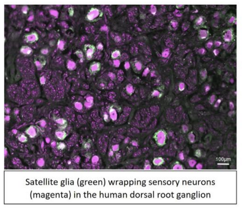 Photos peripheral glia