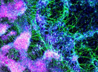 neural crest cells and sensory neurons
